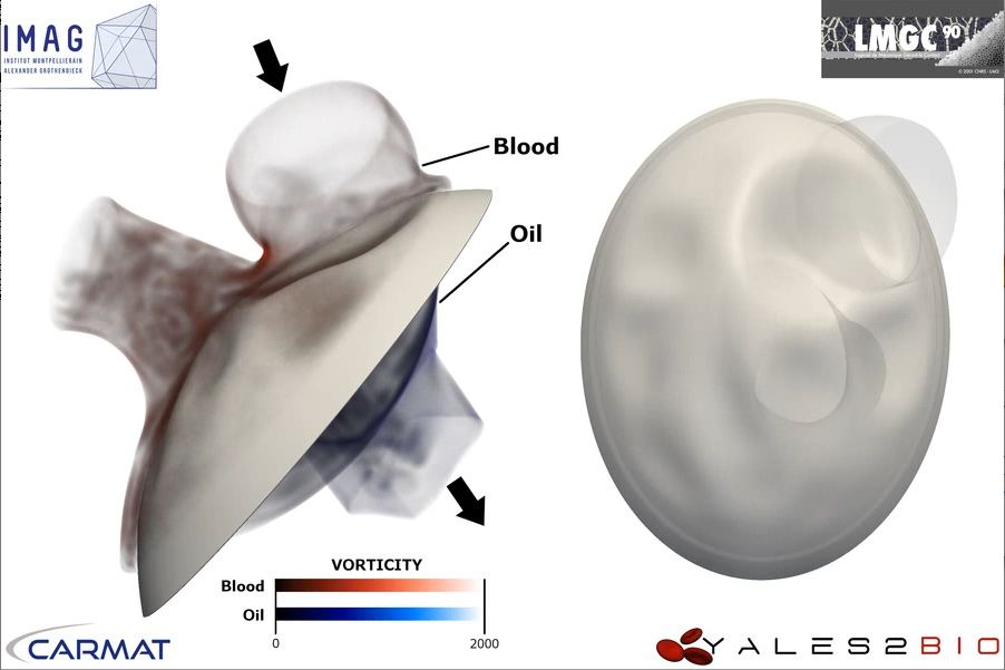 artificial left heart