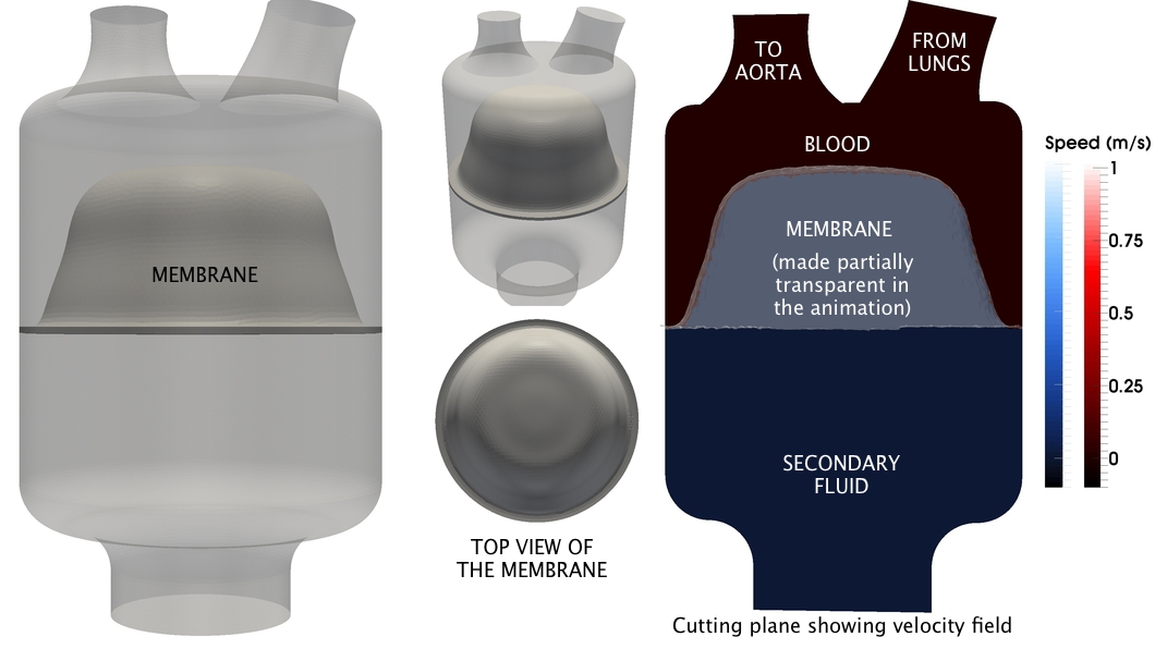 artificial left heart
