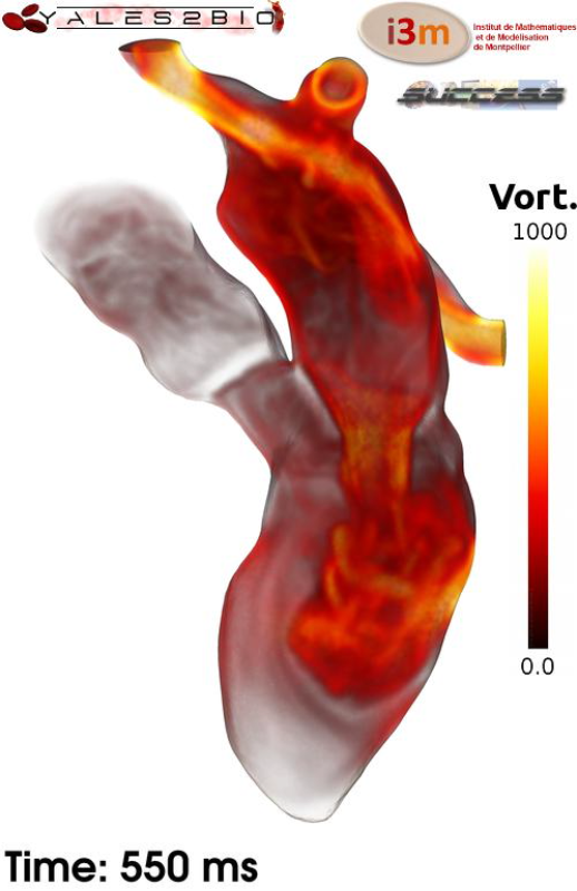 Instantaneous volume rendering of vorticity magnitude (calculation from C. Chnafa, IMAG)